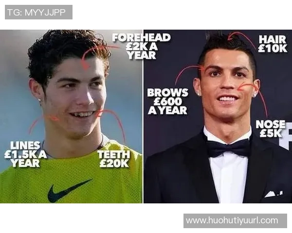 C罗四十岁依然年轻面容整形医生揭秘其可能的多次整形手术经历 C罗四十岁依然年轻面容整形医生揭秘其可能的多次整形手术经历